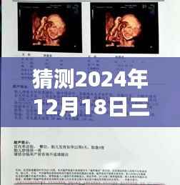 揭秘2024年三维实时彩超,图像解读指南与图片分析技巧